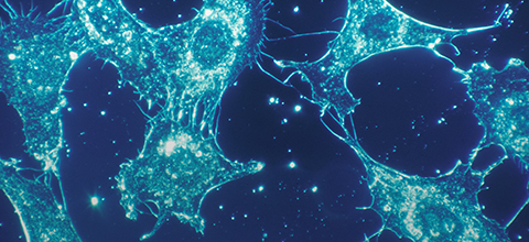 Normal cells of human connective tissue in culture at a magnification of 500x